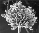 Mikroskopfoto af skimmelsvamp med sporebærende hyfe