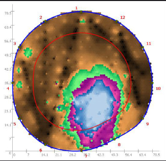 Figur 6. Ved en rådmåling med PICUS© – Sonic Tomograph afgrænser computer­programmet det område, som kan være rådangrebet uden væsentlig indflydelse på træets stabilitet, forudsat at hele splinten uden for den røde cirkel er sund.