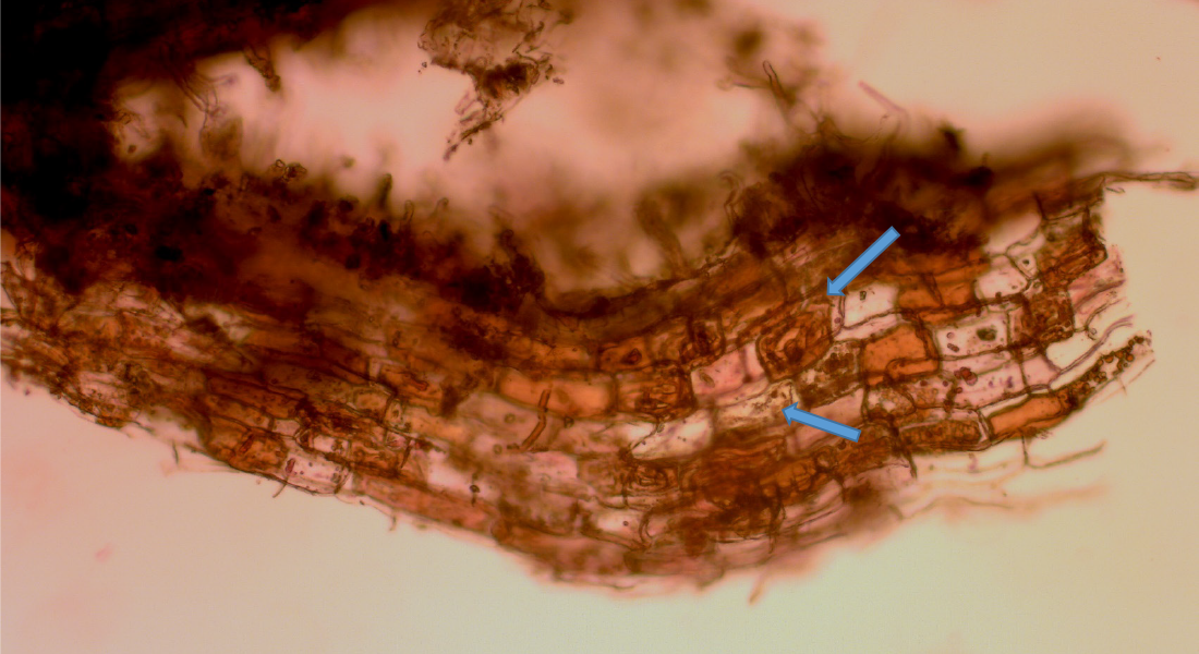Mikroskop billede af rod med A-mykorrhiza. Pile peger på inficerede celler med forskellige stadier af kolonisering.